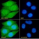 ASCL1 Antibody in Immunocytochemistry (ICC/IF)
