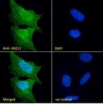 ASCL1 Polyclonal Antibody