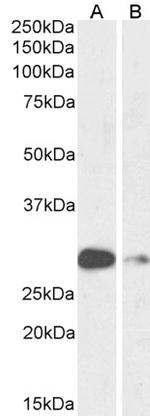ASCL1 Antibody in Western Blot (WB)