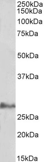 IL17D Antibody in Western Blot (WB)