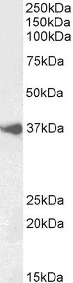 BHLHB5 Antibody in Western Blot (WB)