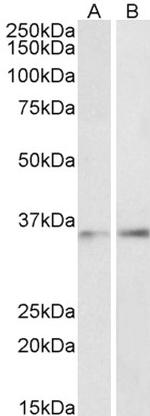 C/EBP beta Polyclonal Antibody