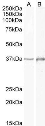 DLX2 Polyclonal Antibody
