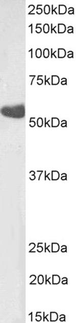 TBXA2R beta Polyclonal Antibody