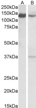 ARS2 Antibody in Western Blot (WB)