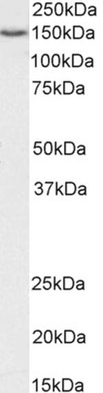 ARS2 Antibody in Western Blot (WB)