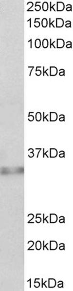 Caspase 6 Polyclonal Antibody