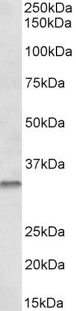 Caspase 6 Polyclonal Antibody
