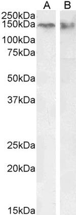 CTCF Polyclonal Antibody