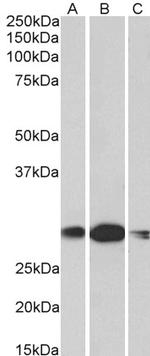 HOXA5 Polyclonal Antibody