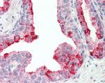 CUTA Polyclonal Antibody