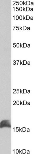 CUTA Antibody in Western Blot (WB)