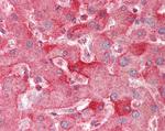 ENPP2 Antibody in Immunohistochemistry (Paraffin) (IHC (P))