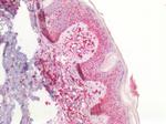 CD44 Antibody in Immunohistochemistry (Paraffin) (IHC (P))