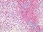 CD44 Antibody in Immunohistochemistry (Paraffin) (IHC (P))