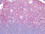 CD44 Antibody in Immunohistochemistry (Paraffin) (IHC (P))