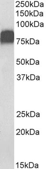 CD44 Antibody in Western Blot (WB)