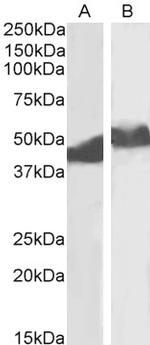 alpha-1 Antitrypsin Polyclonal Antibody