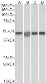 MEK2 Polyclonal Antibody