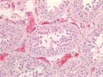 SR-BI Antibody in Immunohistochemistry (Paraffin) (IHC (P))