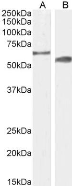 CYP2R1 Antibody in Western Blot (WB)