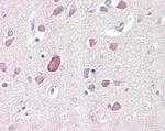 PTGDS Polyclonal Antibody