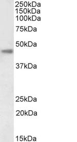 Carbonic Anhydrase XII Polyclonal Antibody, Biotin
