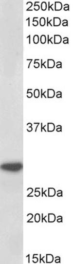 IL-1 beta Antibody in Western Blot (WB)