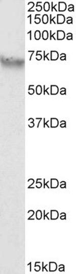 AFP Antibody in Western Blot (WB)