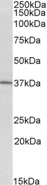 CD38 Antibody in Western Blot (WB)