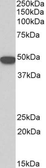 Cytokeratin 18 Antibody in Western Blot (WB)