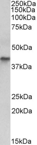Cytokeratin 19 Antibody in Western Blot (WB)