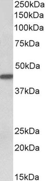 Cytokeratin 19 Antibody in Western Blot (WB)