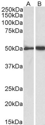 Fibrinogen gamma Polyclonal Antibody