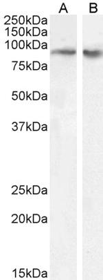 FBXO11 Polyclonal Antibody