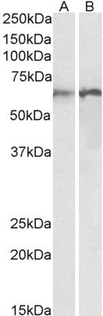 Calreticulin Polyclonal Antibody