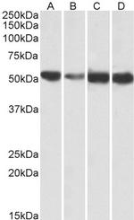 ATP5A1 Polyclonal Antibody