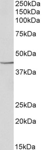 PGK1 Polyclonal Antibody