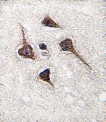 CaMKII alpha Polyclonal Antibody