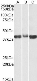 Aldolase A Polyclonal Antibody
