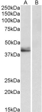 SERPINB1 Antibody in Western Blot (WB)