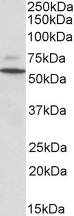 Peripherin Polyclonal Antibody