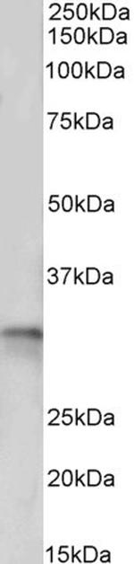 TPM4 Antibody in Western Blot (WB)