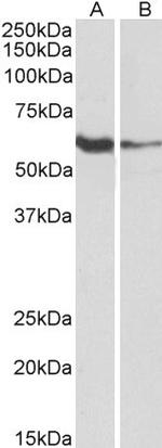 FCRL2 Polyclonal Antibody