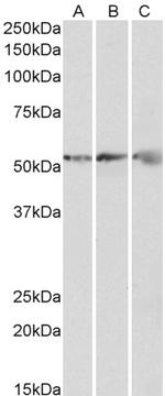 ATP Synthase beta Polyclonal Antibody