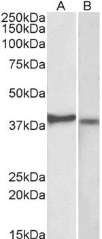 CX3CR1 Polyclonal Antibody