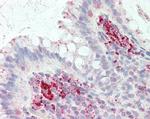 CD123 Antibody in Immunohistochemistry (Paraffin) (IHC (P))