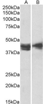 CD123 Antibody in Western Blot (WB)