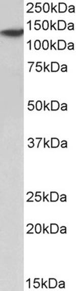 SP140 Polyclonal Antibody