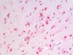 MSI2 Antibody in Immunohistochemistry (Paraffin) (IHC (P))
